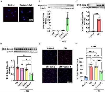 Peptain-1 blocks ischemia/reperfusion-induced retinal capillary degeneration in mice